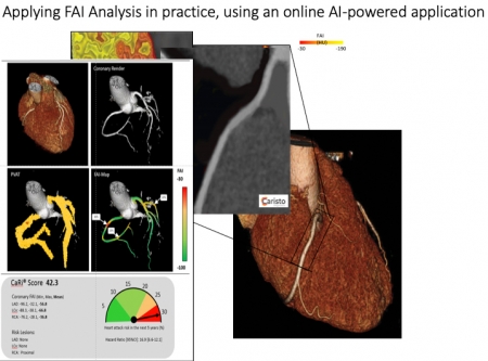 Applying FAI Analysis in practice using an online AI powered application